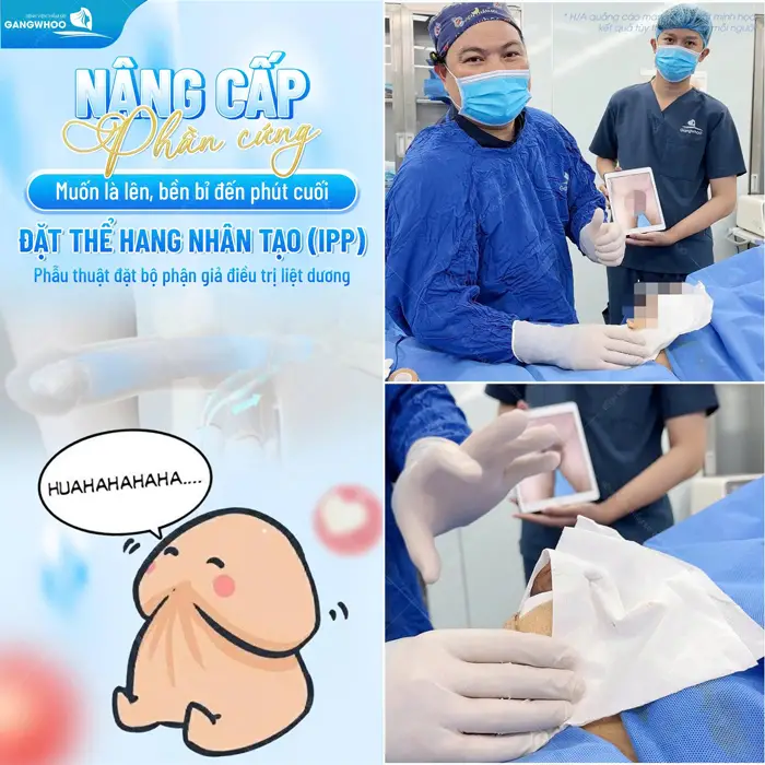 Đặt thể hang nhân tạo nâng cấp bản lĩnh phái nam bền bỉ dài lâu 