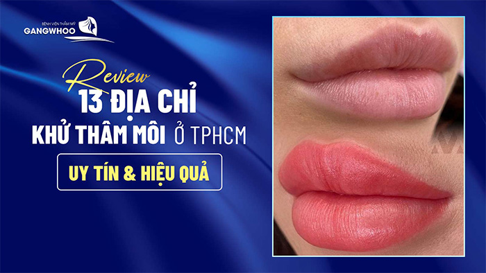 Review 13 Địa Chỉ Khử Thâm Môi Ở TPHCM Uy Tín & Hiệu Quả 15 địa chỉ khử thâm môi ở TPHCM