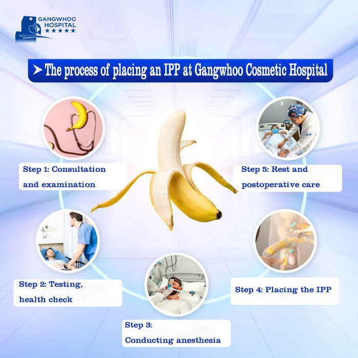 Inflatable Penile Prosthesis IPP