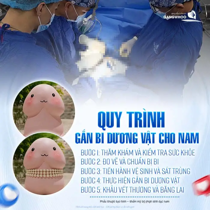 Gắn Bi Dương Vật Cho Nam Là Gì? Chi Phí Bao Nhiêu?