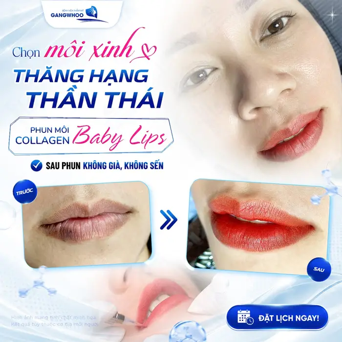 Chọn  môi xinh thăng hạng thần thái sau phun môi Collagen Baby Lips