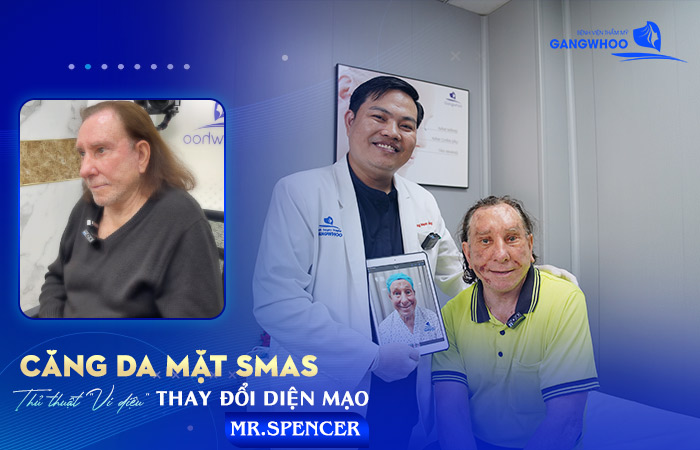 Mr.Spencer “Hồi Sinh” Làn Da Tại Gangwhoo Như “Sống Lại” 30 Năm Trước 3 cang da mat smas thay doi dien mao mr spencer