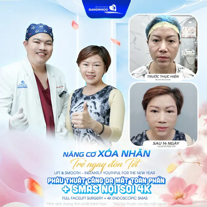 Căng Da Mặt Bây Giờ Có Kịp Tết Không? Tiết Lộ 3 Lý Do Nên Làm 1 Nâng cơ xóa nhăn trẻ hóa toàn diện mạo tôn lên nét đẹp hoàn hảo cho gương mặt tổng thể