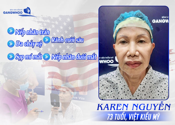 Karen Nguyễn Đến Gangwhoo Tìm Lại Tuổi Xuân Và Cái Kết Vỡ Mộng 8 tinh trang da mat co karen