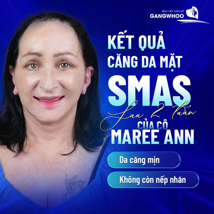 ket qua cang da mat smas cang da mat sau 2 tuan