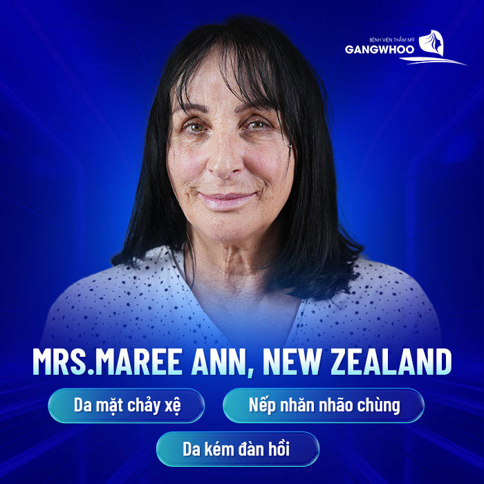 tinh trang da mat cua mrs.maree ann