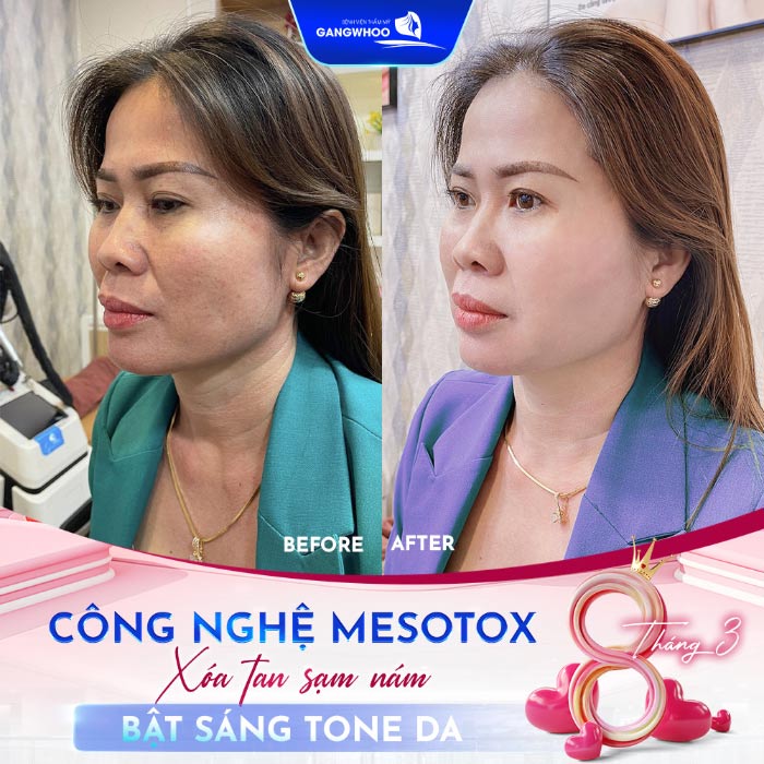 Quà Tặng Ngày 8 Tháng 3 Tặng Vợ