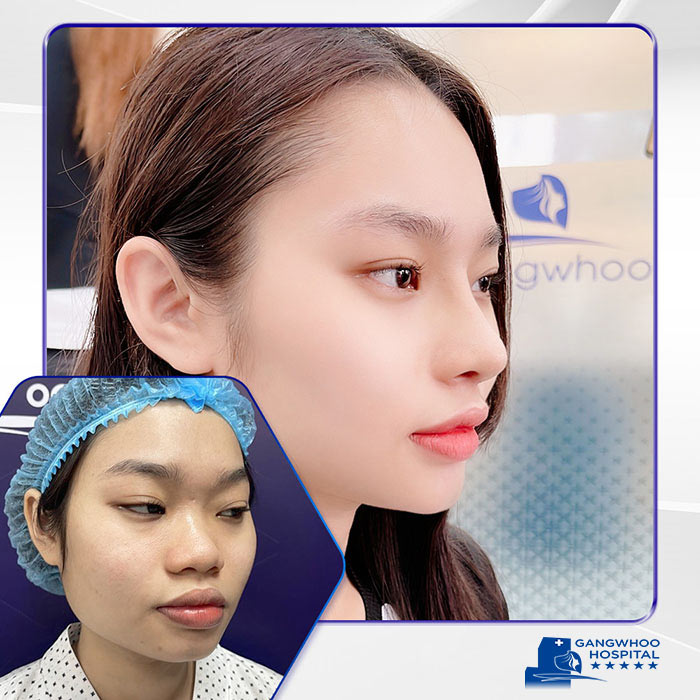 Gangwhoo Cosmetic Hospital Meet Professor Dong Hak Jung