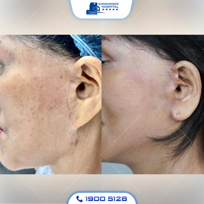 en kh sau cang da mat 2