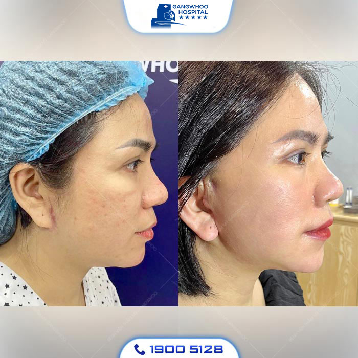 en kh sau cang da mat