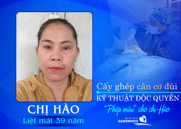 Chị Hào Tìm Lại Ánh Sáng Sau 39 Năm Đằng Đẵng Với Bệnh Liệt Mặt 9 ghep can co dui