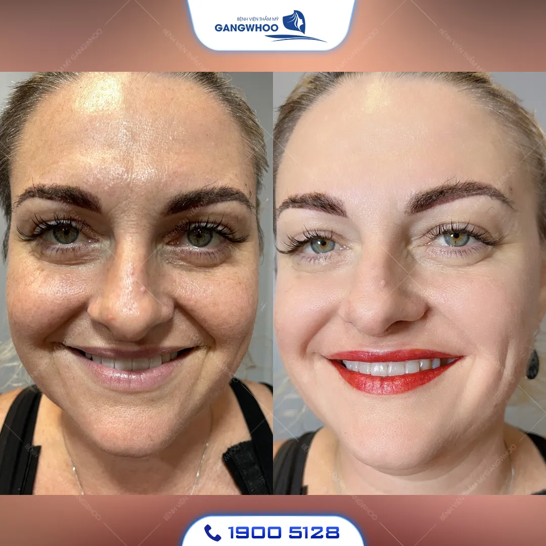 qua tang 8 3 cho nhan vien9 9