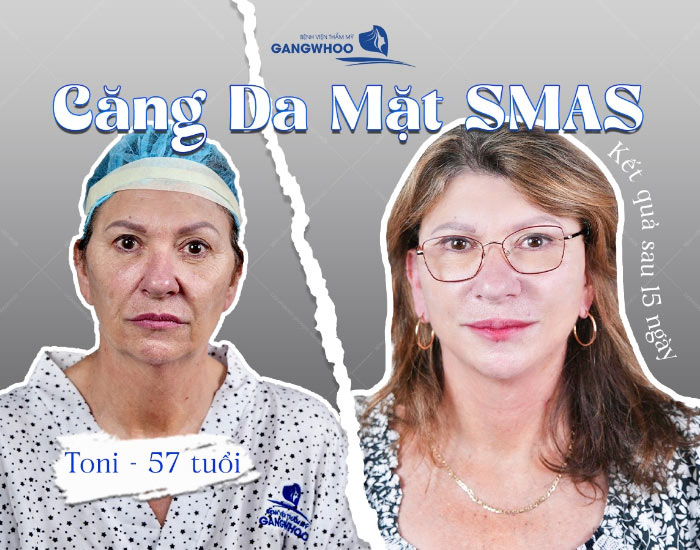 ket qua cang da mat smas