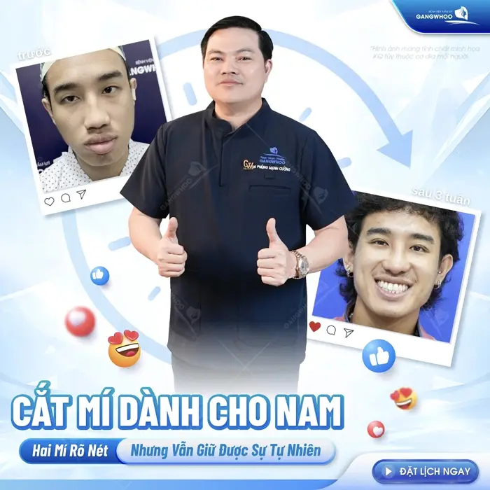 Cắt Mí Mắt Nam Giới Công Nghệ Hàn Quốc Nam Tính, Đổi Vận 1 Cắt mí dành cho nam 2 mí rõ nét giữ được sự tự nhiên