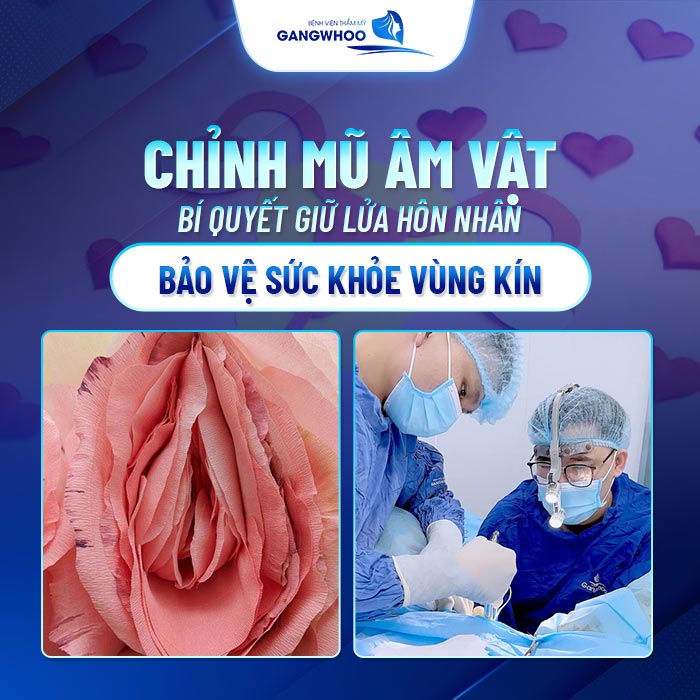 Chỉnh Mũ Âm Vật Là Gì? Tại Sao Phụ Nữ Nên Thực Hiện Sớm 14 Chỉnh Mũ Âm Vật
