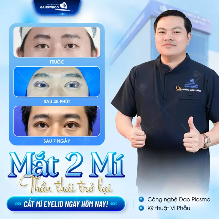 Cắt Mí Mắt Nam Giới Công Nghệ Hàn Quốc Nam Tính, Đổi Vận 9 Tạo hình mắt 2 mí ánh nhìn thêm tự tin, tầm nhìn thêm cuốn hút
