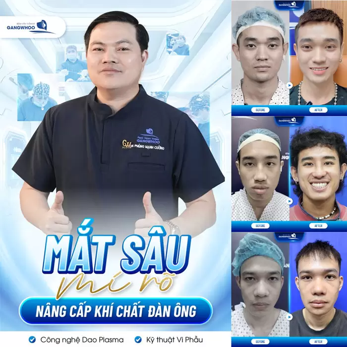 Cắt Mí Mắt Nam Giới Công Nghệ Hàn Quốc Nam Tính, Đổi Vận 4 Nam giới cắt mí nâng tầm khí chất đàn ông nét nào cũng phong độ điển trai