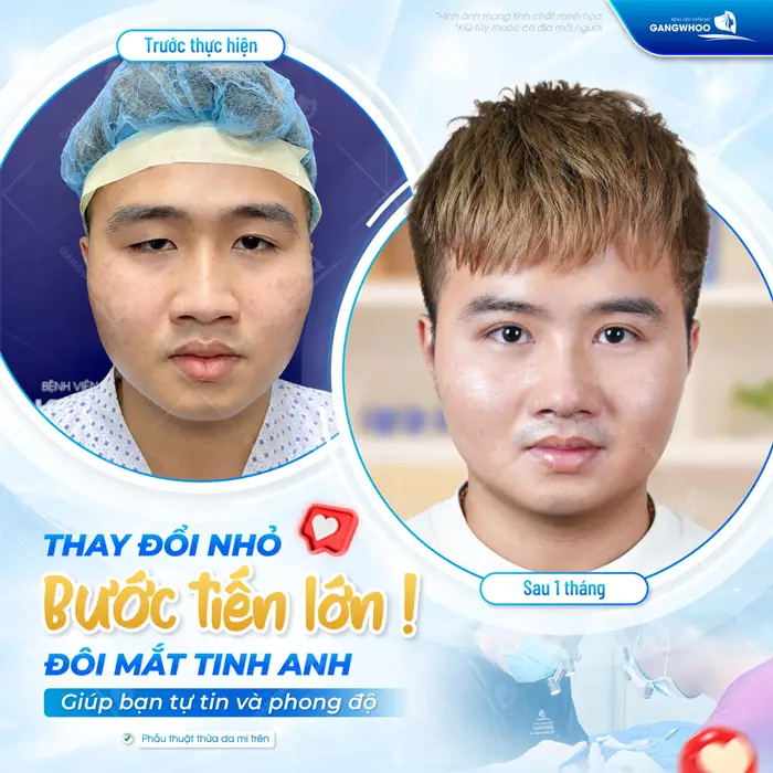 Thay đổi nhỏ bước tiến lớn đôi mắt tinh anh giúp bạn tự tin và phong độ hơn