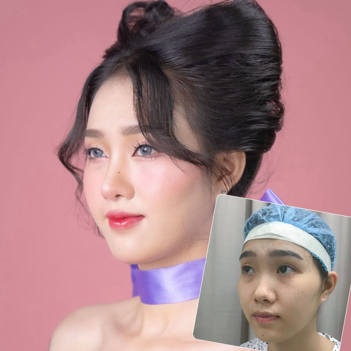 hinh KH nguyen tran thien lan 1
