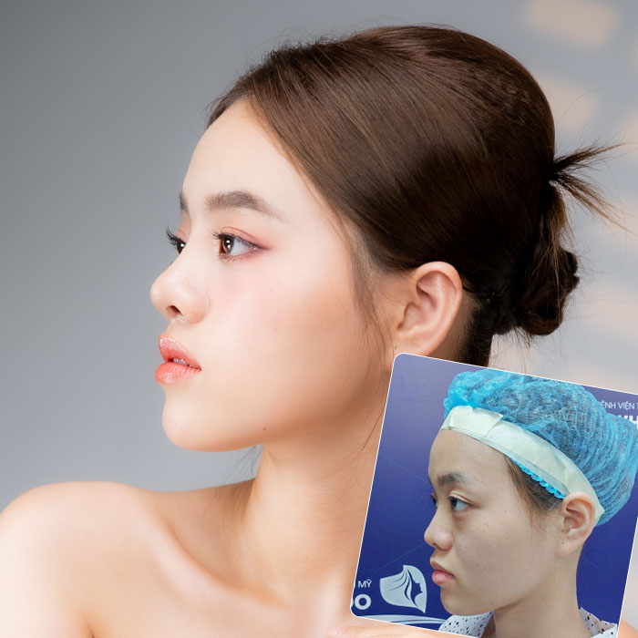 hinh KH quach tu lan 1