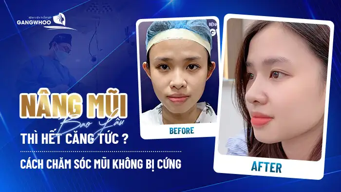 nang mui bao lau het cang tuc