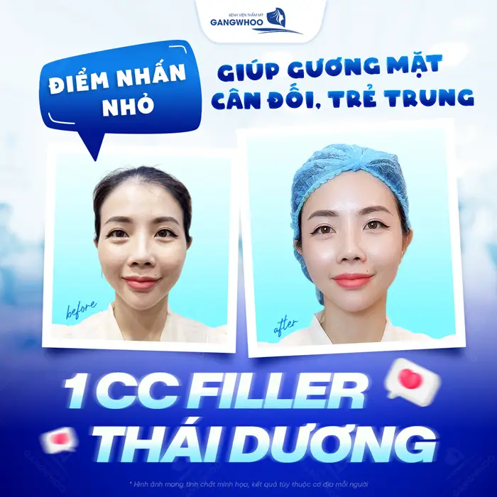 Điểm nhấn nhỏ cho gương mặt thêm cân đối, trẻ trung ngay sau thực hiện
