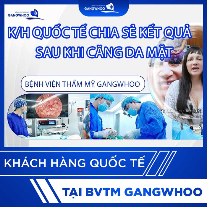 video khach quoc te 5