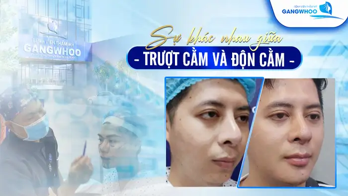 sua khac nhau giua don cam va truot cam