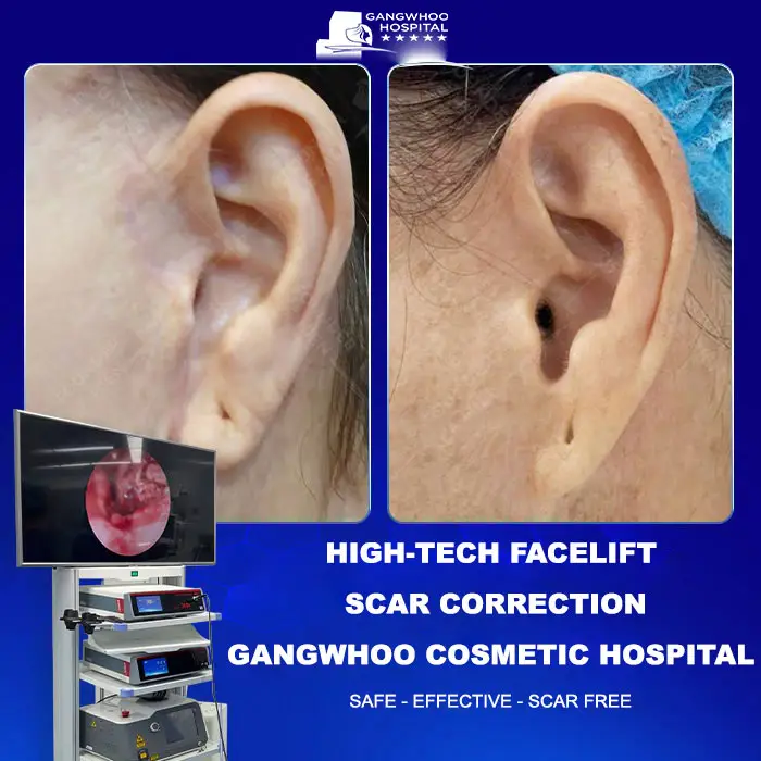 2ensua seo cang da mat cong nghe ca