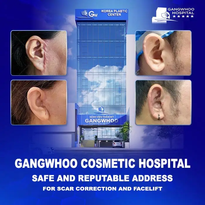 4enbvtm gangwhoo dia chi tham my su