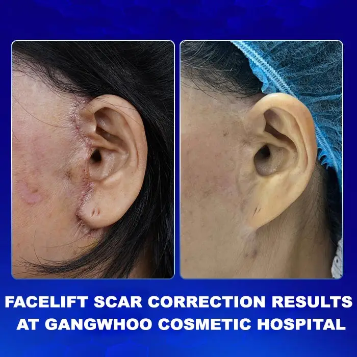 en3ket qua chinh seo cang da mat