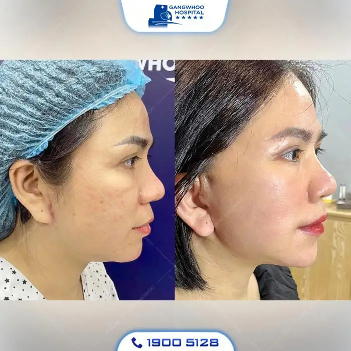 en99kh sau cang da mat