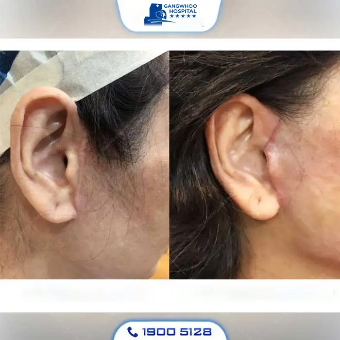 en99seo cang da mat 1 1