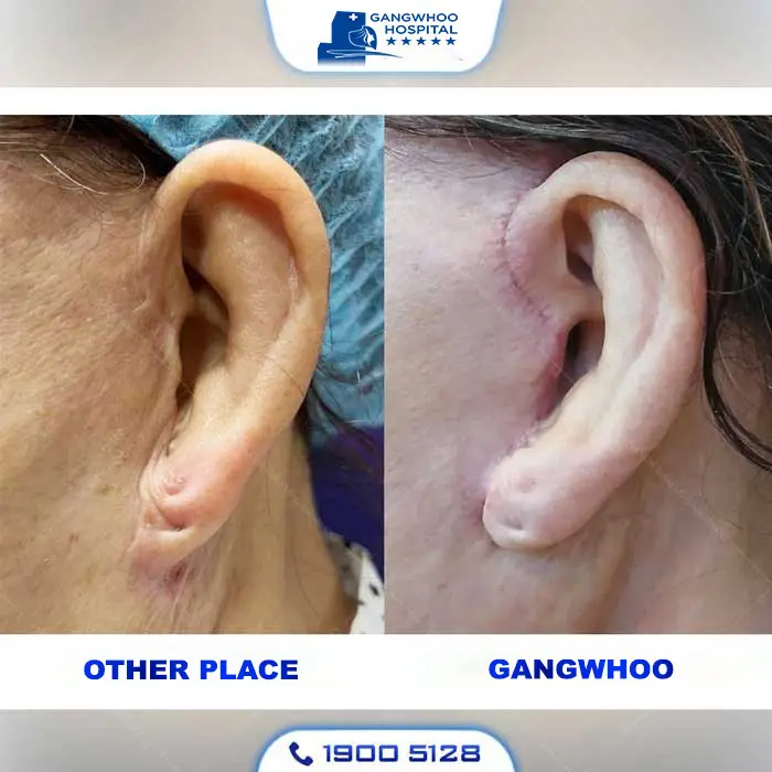 en99seo cang da mat 4