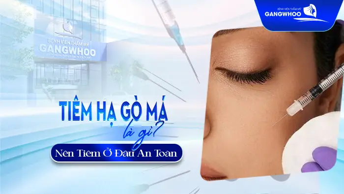 tiem filler ha go ma