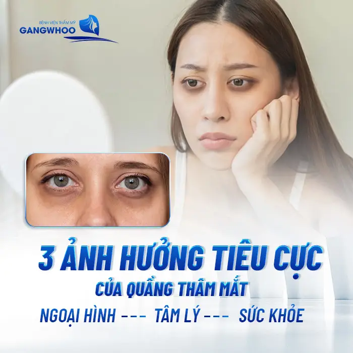 Điều Trị Thâm Mắt: Khôi Phục Đôi Mắt Đẹp Rạng Rỡ, Sáng Ngời 14 3 nguyên nhân gây nên hiện tượng thâm mắt