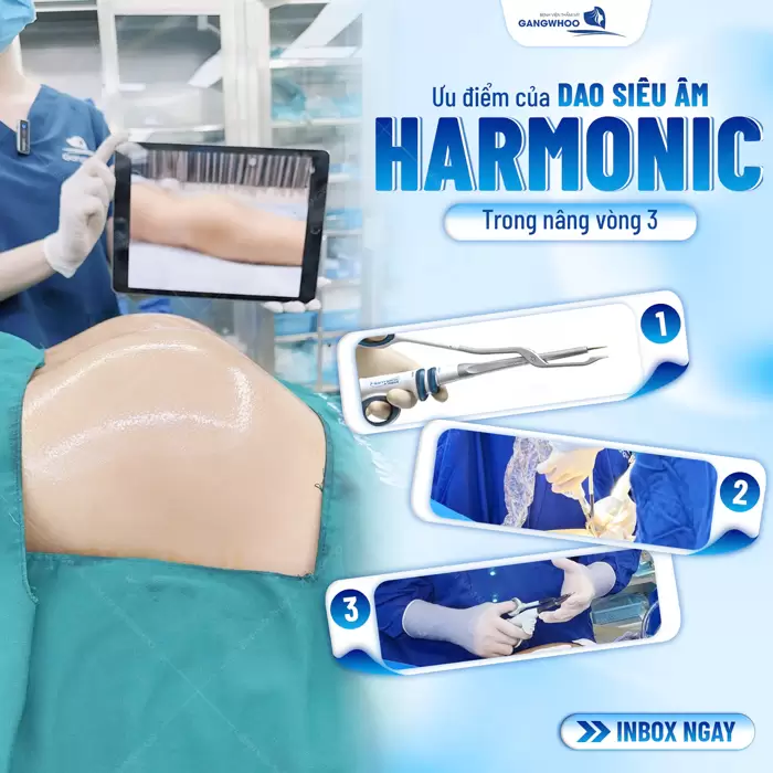 Ứng dụng dao siêu âm Harmonic trong nâng vòng 3 an toàn và hiệu quả 
