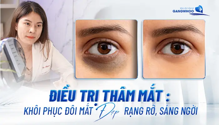 Điều Trị Thâm Mắt: Khôi Phục Đôi Mắt Đẹp Rạng Rỡ, Sáng Ngời 12 Điều Trị Thâm Mắt: Khôi Phục Đôi Mắt Đẹp Rạng Rỡ, Sáng Ngời