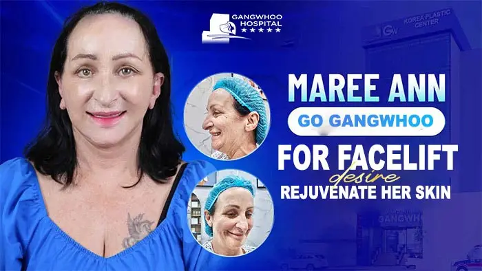 Journey to Gangwhoo for a Facelift