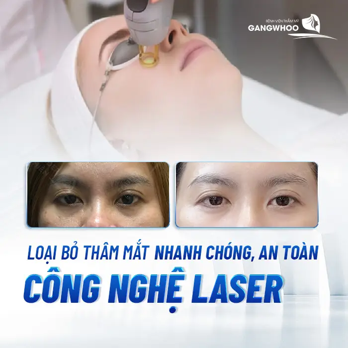 Điều Trị Thâm Mắt: Khôi Phục Đôi Mắt Đẹp Rạng Rỡ, Sáng Ngời 17 Điều Trị Thâm Mắt: Khôi Phục Đôi Mắt Đẹp Rạng Rỡ, Sáng Ngời
