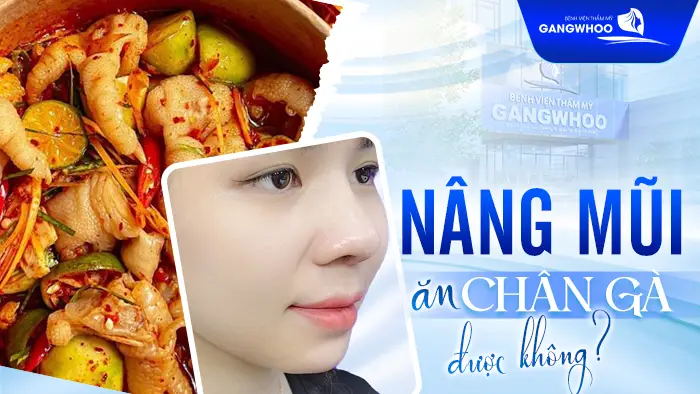 Nâng Mũi Ăn Chân Gà Được Không? Nên Và Không Nên Ăn Gì 1 Nâng Mũi Ăn Chân Gà Được Không? Nên Và Không Nên Ăn Gì