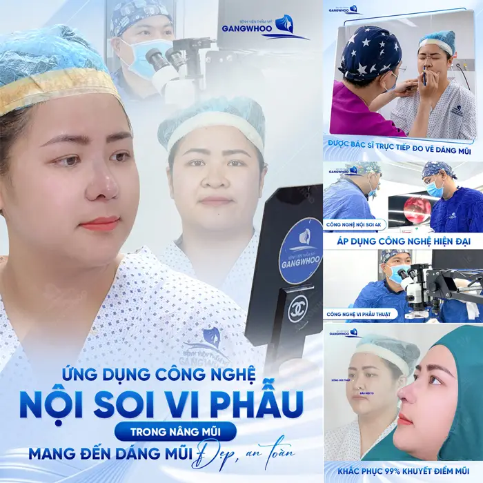 Nâng Mũi Sụn Sườn Tự Thân Nội Soi Vi Phẫu Là Gì? Ai Nên Thực Hiện 32 Nâng Mũi Sụn Sườn Tự Thân Nội Soi Vi Phẫu