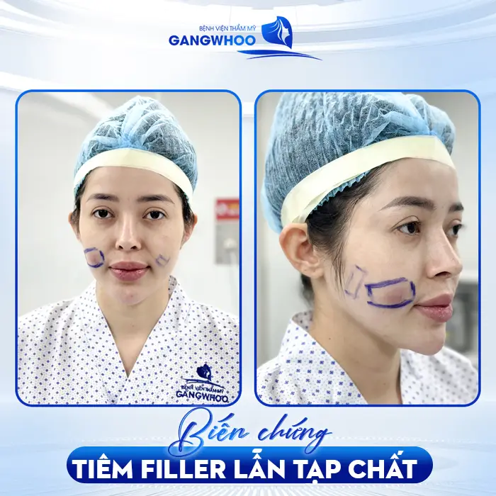 Hot Tiktoker Linh Barbie và Hành Trình Tìm Lại Nhan Sắc Tại BVTM Gangwhoo