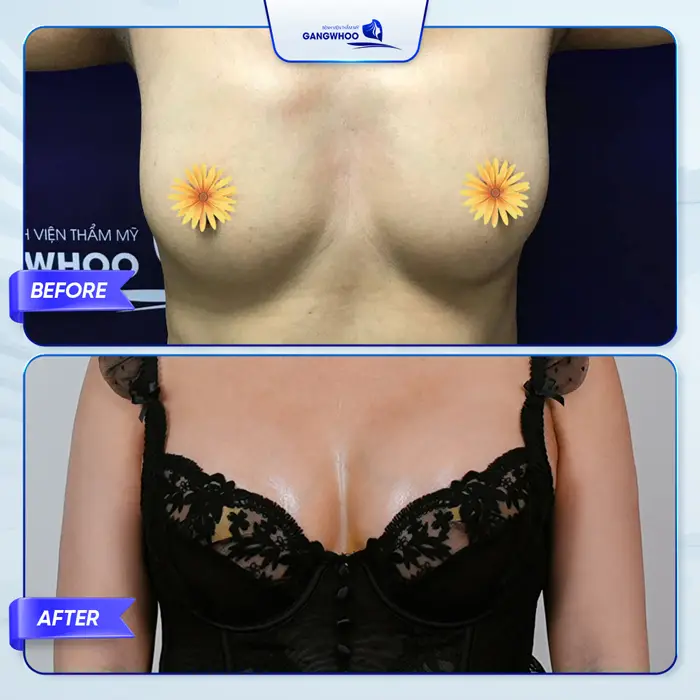 ceo ngoc hien trung tu nhan sac 4