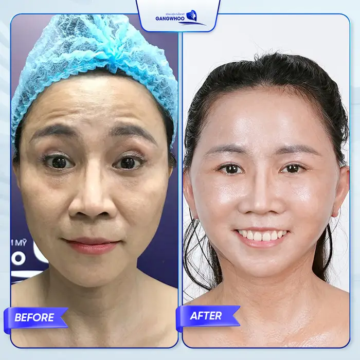 ceo ngoc hien trung tu nhan sac 5