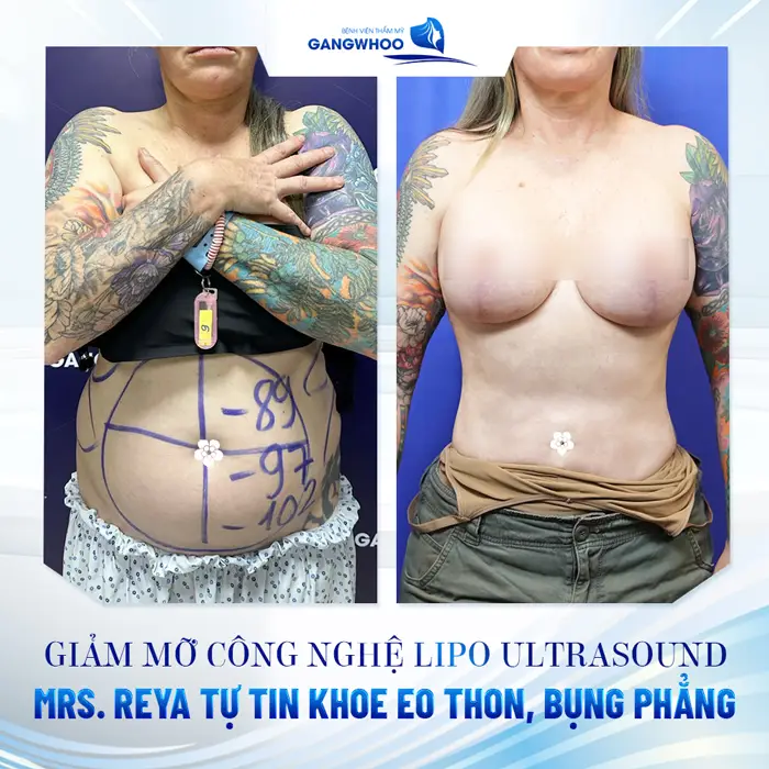 Vượt Ngàn Dặm Xa Xôi đến Gangwhoo Mrs. Reya (Úc)Tự Tin Khoe Eo Thon - Ngực Đẹp 12 Vượt Ngàn Dặm Xa Xôi: Mrs. Reya (Úc)Tự Tin Khoe Eo Thon - Ngực Đẹp