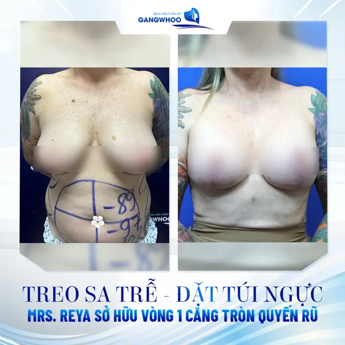 Vượt Ngàn Dặm Xa Xôi đến Gangwhoo Mrs. Reya (Úc)Tự Tin Khoe Eo Thon - Ngực Đẹp 11 Vượt Ngàn Dặm Xa Xôi: Mrs. Reya (Úc)Tự Tin Khoe Eo Thon - Ngực Đẹp