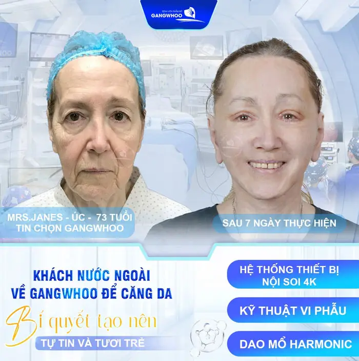 Mrs Jane 73 Tuổi Tìm Lại Tuổi Xuân Sau Combo Trùng Tu Nhan Sắc 