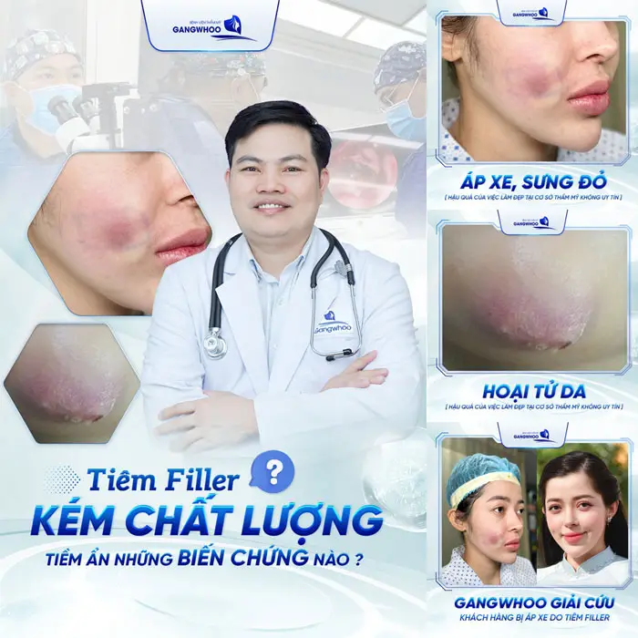 Hot Tiktoker Linh Barbie và Hành Trình Tìm Lại Nhan Sắc Tại BVTM Gangwhoo