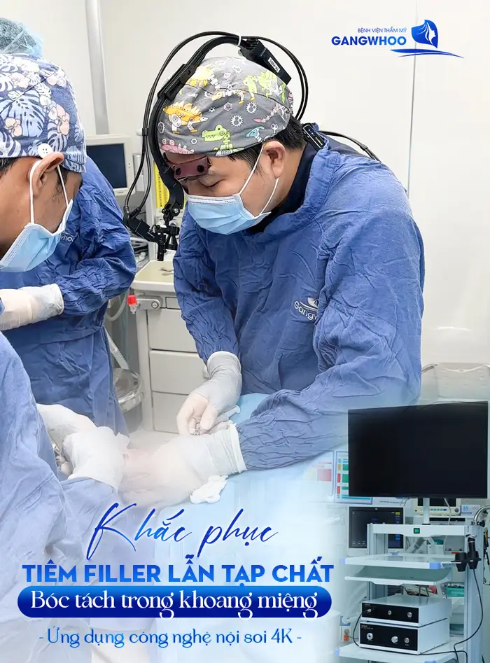 tim filler lan tap chat bien chung khon luong